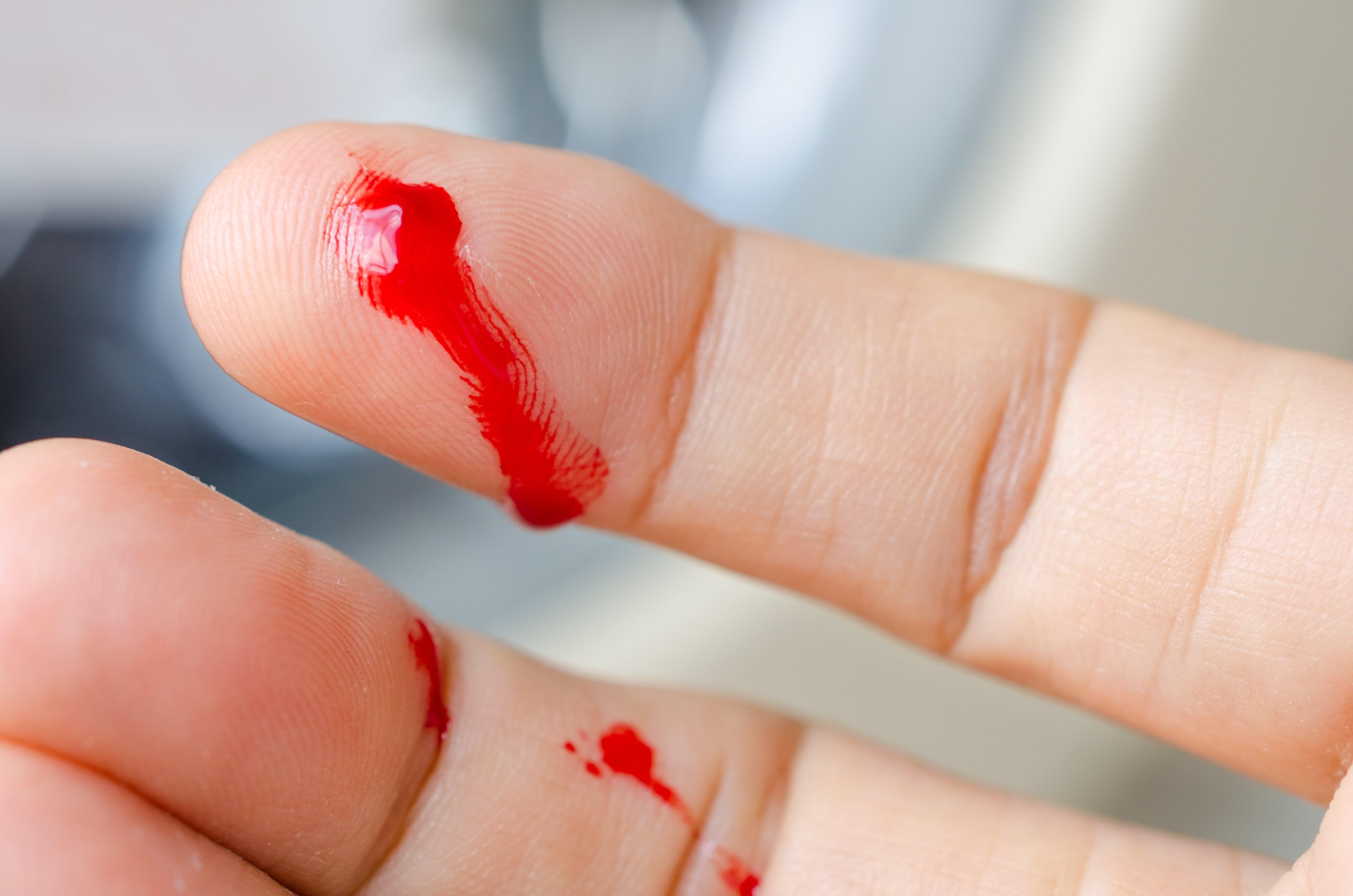 Bleeding.